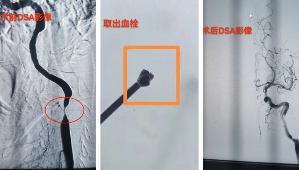 1706775382575950.png